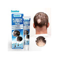 Alopecia Hair Growth Cream – 100% Proven to Restore Bald Spots & Regrow Hair 20g